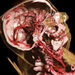 レス12番のサムネイル画像